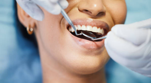 Best Emergency Wisdom Teeth Removal in Greencastle, IN