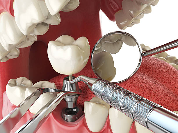 Best Cosmetic Emergency Dentistry in Greencastle, IN